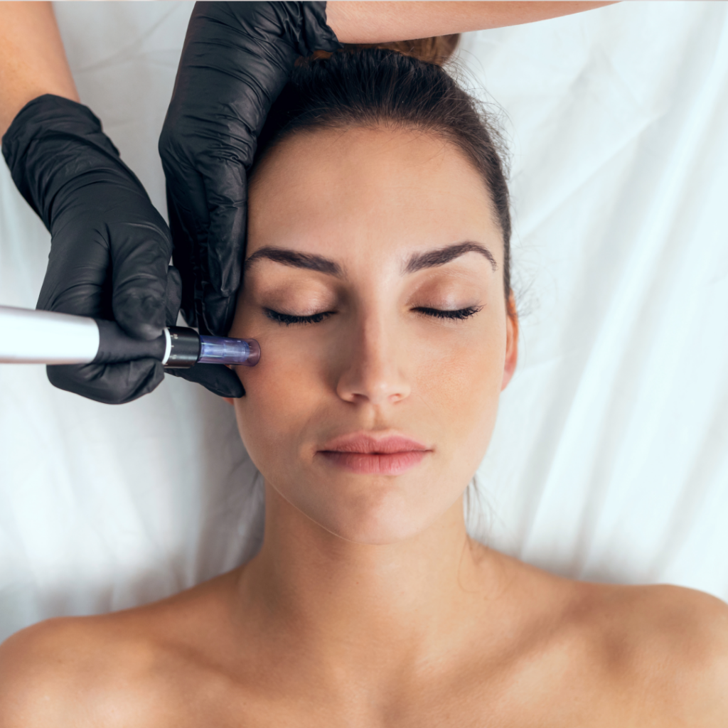 Zabieg mezoterapii mikroigłowej Dermapen wykonywany w Nail Space Poznań przez doświadczonego specjalistę.